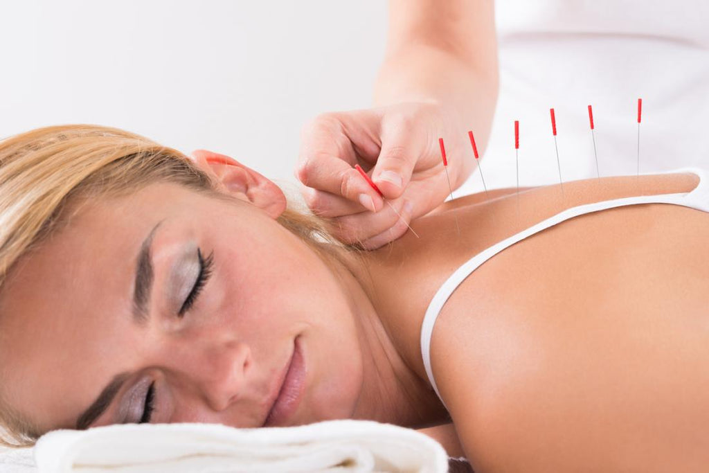 Does Acupuncture Really Work?